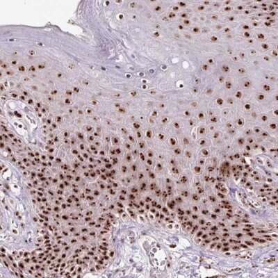 Immunohistochemistry: Nucleostemin Antibody [NBP2-38325] - Staining of human skin shows strong nucleolar positivity in epidermal cells.