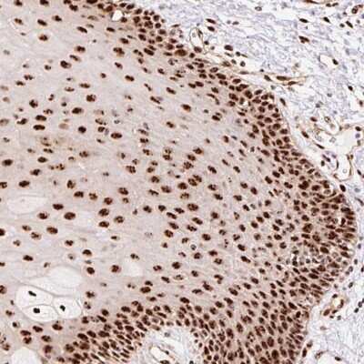 Immunohistochemistry: Nucleostemin Antibody [NBP2-38326] - Staining of human oral mucosa shows strong nuclear/ nucleolar positivity in squamous epithelial cells.