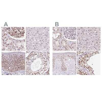 <b>Independent Antibodies Validation. </b>Immunohistochemistry-Paraffin: Nucleostemin Antibody [NBP2-38326] - Staining of human kidney, liver, skin and testis using Anti-GNL3 antibody NBP2-38326 (A) shows similar protein distribution across tissues to independent antibody NBP2-38325 (B).