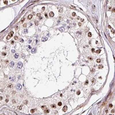 Immunohistochemistry-Paraffin: Nucleostemin Antibody [NBP2-38326] - Staining of human testis.