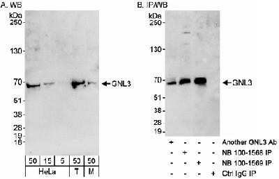 Western Blot: Nucleostemin Antibody [NB100-1568] - Detection of Human and Mouse GNL3 on HeLa whole cell lysate using NB100-1568. GNL3 was also immunoprecipitated using rabbit anti-GNL3 antibodies NB100-1569 and another GNL3 Ab.