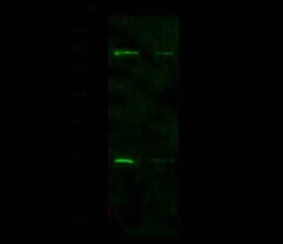 Western Blot: Nucleostemin Antibody [NBP2-98743] - Anti-Nucleostemin rabbit polyclonal antibody at 1:500 dilution. Lane A: K562 Whole Cell Lysate. Lane B: Hela Whole Cell Lysate. Lysates/proteins at 30 ug per lane. Secondary Goat Anti-Rabbit IgG H&L (Dylight 800) at 1/10000 dilution. Developed using the Odyssey technique. Performed under reducing conditions. Predicted band size: 62 kDa. Observed band size: 62 kDa (We are unsure as to the identity of these extra bands).