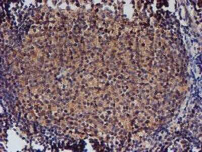 Immunohistochemistry: Nucleotide binding protein like Antibody (OTI5D5) - Azide and BSA Free [NBP2-73094] - Staining of paraffin-embedded Human tonsil using anti-Nucleotide binding protein like mouse monoclonal antibody.