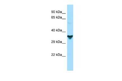 Western Blot: Nucleotide binding protein like Antibody [NBP2-87960] - Host: Rabbit. Target Name: NUBPL. Sample Type: Jurkat Whole Cell lysates. Antibody Dilution: 1.0ug/ml