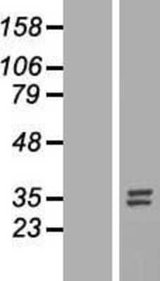 Western Blot: Nucleotide binding protein like Overexpression Lysate (Adult Normal) [NBL1-13847] Left-Empty vector transfected control cell lysate (HEK293 cell lysate); Right -Over-expression Lysate for Nucleotide binding protein like.