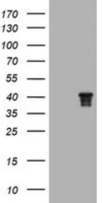 Western Blot: Nudel Antibody (1G7) [NBP2-45855] - Analysis of HEK293T cells were transfected with the pCMV6-ENTRY control (Left lane) or pCMV6-ENTRY Nudel.