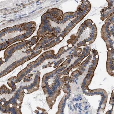 Immunohistochemistry-Paraffin: Nudel Antibody [NBP1-92206] - Staining of human duodenum shows strong cytoplasmic and membranous positivity in glandular cells.