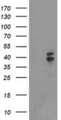 Western Blot: Nudel Antibody (OTI5E11) - Azide and BSA Free [NBP2-73104] - HEK293T cells were transfected with the pCMV6-ENTRY control (Left lane) or pCMV6-ENTRY Nudel (Right lane) cDNA for 48 hrs and lysed. Equivalent amounts of cell lysates (5 ug per lane) were separated by SDS-PAGE and immunoblotted with anti-Nudel.