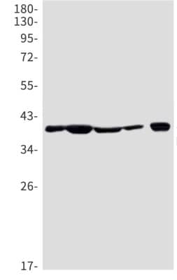 Western Blot: Nudel Antibody (S05-1D0) [NBP3-19994] - Western blot detection of Nudel in Hela (Lane 1), A549 (Lane 2), HL-60 (Lane 3), U251 (Lane 4), U87-MG (Lane 5) cell lysates using NBP3-19994 (1:1000 diluted). Predicted band size: 38kDa. Observed band size: 38kDa.