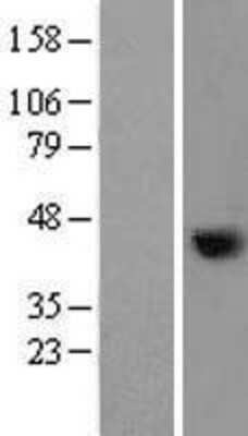 Western Blot: Nudel Overexpression Lysate (Adult Normal) [NBL1-13524] Left-Empty vector transfected control cell lysate (HEK293 cell lysate); Right -Over-expression Lysate for Nudel.