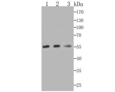 Western Blot: Nuf2 Antibody (JG34-64) [NBP2-76855] - Western blot analysis of Nuf2 on different cell lysates using anti-Nuf2 at 1/1,000 dilution.Positive control:Line 1: K562 Line 2: PC-3MLine 3: THP-1