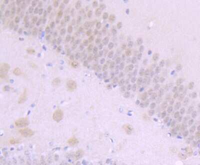 Immunohistochemistry-Paraffin: Numb Antibody (JM10-023) [NBP2-66991] - Analysis of paraffin-embedded mouse brain tissue using anti-NUMB antibody. Counter stained with hematoxylin.