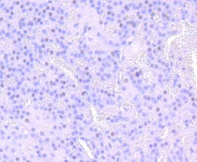 Immunohistochemistry-Paraffin: Numb Antibody (JM10-023) [NBP2-66991] - Analysis of paraffin-embedded rat adrenal gland tissue using anti-NUMB antibody. Counter stained with hematoxylin.