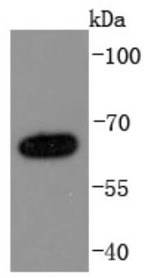 Western Blot: Numb Antibody (JM10-023) [NBP2-66991] - Analysis of NUMB on A431 cells lysates using anti-NUMB antibody at 1/1,000 dilution.