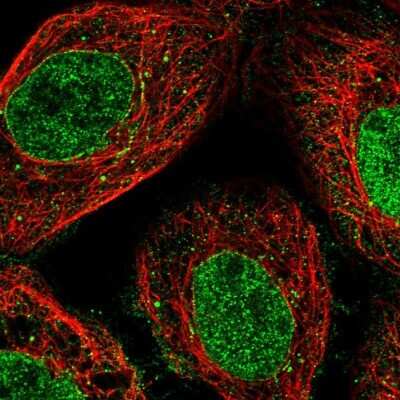 Immunocytochemistry/Immunofluorescence: Nup53 Antibody [NBP1-92214] - Immunofluorescent staining of human cell line A-431 shows localization to nucleoplasm & nuclear membrane.