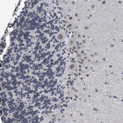 Immunohistochemistry-Paraffin: Nup53 Antibody [NBP1-92214] - Staining of human cerebellum shows strong positivity in nuclear membrane in Purkinje cells.