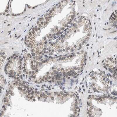 Immunohistochemistry-Paraffin: Nup53 Antibody [NBP1-92214] - Staining of human prostate shows strong positivity in nuclear membrane in glandular cells.