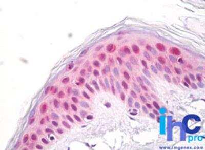 Immunohistochemistry-Paraffin: Nup53 Antibody [NBP2-24525] - Formalin-fixed, paraffin-embedded human skin (epidermis) stained with NUP35 antibody at 10 ug/ml. Staining of formalin-fixed tissues is enhanced by boiling tissue sections in 10 mM sodium citrate buffer, pH 6.0 for 10-20 min followed by cooling at RT for 20 min.