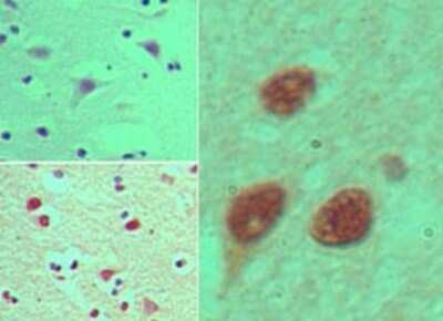 Immunohistochemistry-Paraffin: Nup53 Antibody [NBP2-24637] - Analysis of NUP35 in formalin-fixed, paraffin-embedded human brain tissue using an isotype control (top left) and this antibody (bottom left, right) at 5 ug/ml.