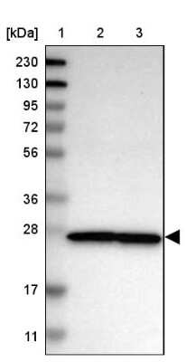 Western Blot: Nup53 Antibody [NBP1-92212] - Lane 1: Marker  [kDa] 230, 130, 95, 72, 56, 36, 28, 17, 11.  Lane 2: Human cell line RT-4.  Lane 3: Human cell line U-251MG sp