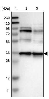 Western Blot: Nup53 Antibody [NBP1-92214] - Lane 1: Marker  [kDa] 230, 130, 95, 72, 56, 36, 28, 17, 11.  Lane 2: Human cell line RT-4.  Lane 3: Human cell line U-251MG sp