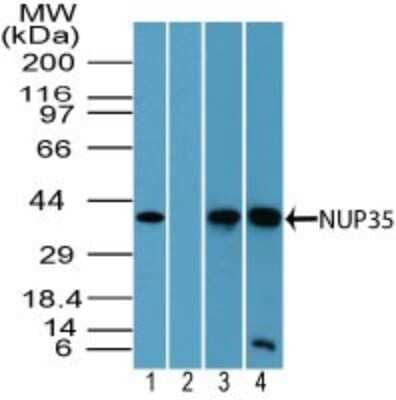 Western Blot: Nup53 Antibody [NBP2-24637] - Analysis of NUP35 in human liver lysate in the 1) absence and 2) presence of immunizing peptide, 3) mouse brain lysate and 4) rat brain lysate using NBP2-24637. Goat anti-rabbit Ig HRP secondary antibody and PicoTect ECL substrate solution were used for this test.