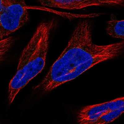 Immunocytochemistry/Immunofluorescence: Nurim Antibody [NBP2-55890] - Staining of human cell line RH-30 shows localization to nuclear membrane.