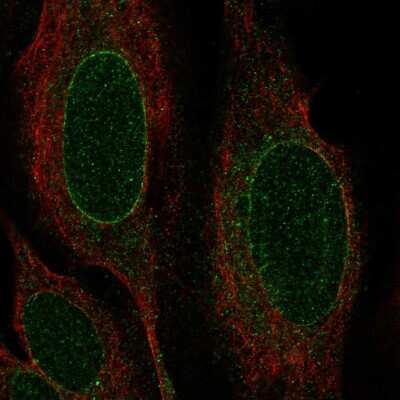 Immunocytochemistry/Immunofluorescence: Nurim Antibody [NBP2-56443] - Staining of human cell line U-2 OS shows localization to nuclear membrane.