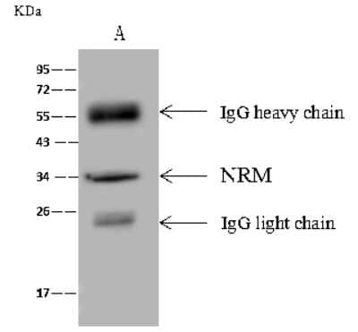 Immunoprecipitation: Nurim Antibody [NBP2-99482] - Nurim was immunoprecipitated using: Lane A: 0.5 mg HeLa Whole Cell Lysate. 4 ul anti-Nurim rabbit polyclonal antibody and 60 ug of Immunomagnetic beads. Protein A/G. Primary antibody: Anti-Nurim rabbit polyclonal antibody, at 1:100 dilution. Secondary antibody: Goat Anti-Rabbit IgG (H+L)/HRP at 1/10000 dilution. Developed using the ECL technique. Performed under reducing conditions. Predicted band size: 29 kDa. Observed band size: 34 kDa