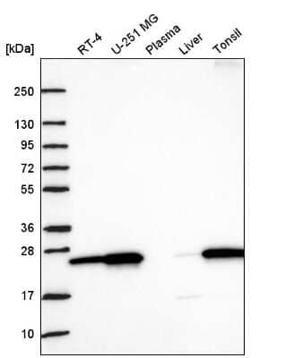 Western Blot: Nurim Antibody [NBP2-56443] - Western blot analysis in human cell line RT-4, human cell line U-251 MG, human plasma, human liver tissue and human tonsil tissue.