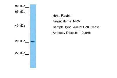 Western Blot: Nurim Antibody [NBP2-87942] - Host: Rabbit. Target Name: NRM. Sample Tissue: Human Jurkat Whole Cell lysates. Antibody Dilution: 1ug/ml