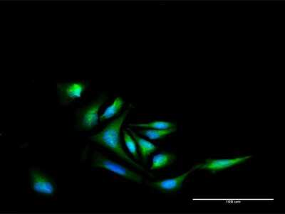 Immunocytochemistry/Immunofluorescence: Nurr1/NGFI-B beta/NR4A2 Antibody [H00004929-D01P] - Analysis of antibody to NR4A2 on HeLa cell. Antibody concentration 30 ug/ml.