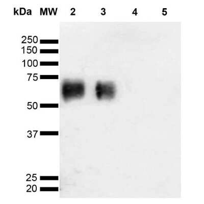 Western Blot analysis of Glycoconjugates showing detection of 67 kDa O-GalNAc protein using Mouse Anti-O-GalNAc Monoclonal Antibody, Clone 9B9 (NBP2-59309). Lane 1: Molecular Weight Ladder (MW). Lane 2: O-GalNAc-BSA. Lane 3: GalNAc-BSA. Lane 4: Galactose-BSA. Lane 5: Glucose-BSA. Load: 2.0 ug. Block: 5% Skim Milk in TBST. Primary Antibody: Mouse Anti-O-GalNAc Monoclonal Antibody (NBP2-59309) at 1:1000 for 2 hours at RT. Secondary Antibody: Goat Anti-Mouse IgG: HRP at 1:2000 for 60 min at RT. Color Development: ECL solution for 5 min in RT. Predicted/Observed Size: 67 kDa.