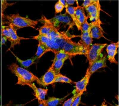 Immunocytochemistry/Immunofluorescence: O-GlcNAc Antibody (9H6) [NBP2-59385] - Tissue: Embryonic kidney cells (HEK293). Species: Human. Fixation: 5% Formaldehyde for 5 min. Primary Antibody: Mouse Anti-O-GlcNAc Monoclonal Antibody at 1:50 for 30-60 min at RT. Secondary Antibody: Goat Anti-Mouse Alexa Fluor 488 at 1:1500 for 30-60 min at RT. Counterstain: Phalloidin Alexa Fluor 633 F-Actin stain; DAPI (blue) nuclear stain at 1:250, 1:50000 for 30-60 min at RT. Magnification: 20X (2X Zoom). (D) Composite. Courtesy of: Dr. Robert Burke, University of Victoria.