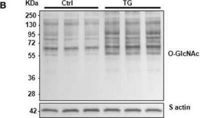 Western Blot: O-GlcNAc Antibody (RL2) [NB300-524] - Impact of OGA inhibition by thiamet G in primary cultures of NCM. Representative western blots (left panel) and quantification (right panel) of O-GlcNAcylated proteins levels in control (Ctrl) and NCM treated with 100 nM of thiamet G (TG) during 24 h (n = 12). Image collected and cropped by Citeab from the following publication (Interplay Between Phosphorylation and O-GlcNAcylation of Sarcomeric Proteins in Ischemic Heart Failure. Front Endocrinol (Lausanne) (2018) licensed under a CC-BY license.