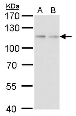 Western Blot: O-GlcNAc Transferase p110 subunit Antibody (2037) [NBP2-43755] - Analysis of A. 30 ug 293T B. 30 ug HeLa 7.5 % SDS-PAGE O-GlcNAc transferase antibody [2037] dilution: 1:1000.