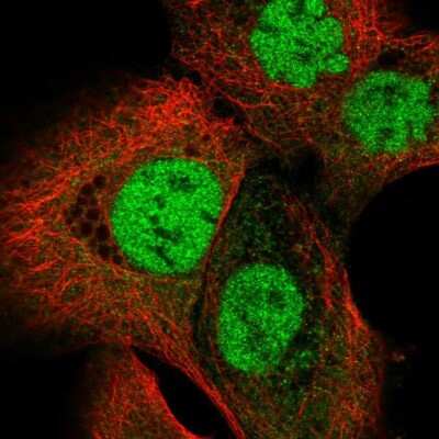 <b>Independent Antibodies Validation. </b>Immunocytochemistry/Immunofluorescence: O-GlcNAc Transferase p110 subunit Antibody [NBP2-55252] - Staining of human cell line A-431 shows localization to nucleoplasm.