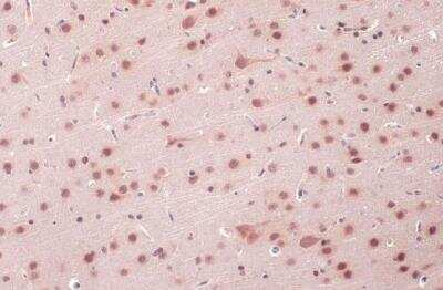 Immunohistochemistry-Paraffin: O-GlcNAc Transferase p110 subunit Antibody [NBP1-32791] - Rat brain. O-GlcNAc transferase stained by O-GlcNAc transferase antibody diluted at 1:500. Antigen Retrieval: Citrate buffer, pH 6.0, 15 min. 