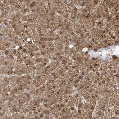 <b>Independent Antibodies Validation. </b>Immunohistochemistry-Paraffin: O-GlcNAc Transferase p110 subunit Antibody [NBP1-89845] - Staining of human liver shows moderate nuclear and cytoplasmic positivity in hepatocytes.