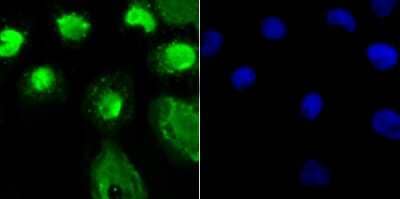 Immunocytochemistry/Immunofluorescence: O-GlcNAc Transferase p110 subunit Antibody (JB44-39) [NBP2-75601] - Staining OGT in A431 cells (green). The nuclear counter stain is DAPI (blue). Cells were fixed in paraformaldehyde, permeabilised with 0.25% Triton X100/PBS.