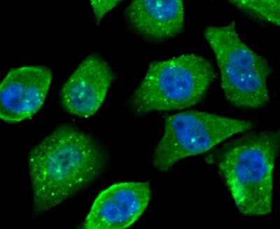 Immunocytochemistry/Immunofluorescence: O-GlcNAc Transferase p110 subunit Antibody (JB44-39) [NBP2-75601] - Staining OGT in PC-3M cells (green). The nuclear counter stain is DAPI (blue). Cells were fixed in paraformaldehyde, permeabilised with 0.25% Triton X100/PBS.