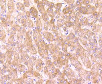 Immunohistochemistry-Paraffin: O-GlcNAc Transferase p110 subunit Antibody (JB44-39) [NBP2-75601] - Analysis of paraffin-embedded human liver tissue using anti-OGT antibody. Counter stained with hematoxylin.