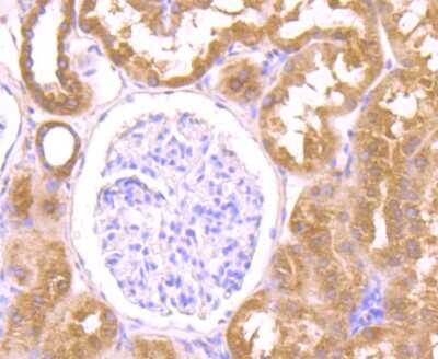 Immunohistochemistry-Paraffin: O-GlcNAc Transferase p110 subunit Antibody (JB44-39) [NBP2-75601] - Analysis of paraffin-embedded human kidney tissue using anti-OGT antibody. Counter stained with hematoxylin.