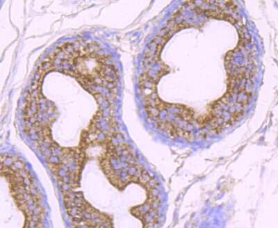 Immunohistochemistry-Paraffin: O-GlcNAc Transferase p110 subunit Antibody (JB44-39) [NBP2-75601] - Analysis of paraffin-embedded rat epididymis tissue using anti-OGT antibody. Counter stained with hematoxylin.