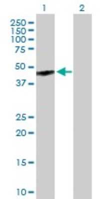 Western Blot: OA1 Antibody [H00004935-B01P] - Analysis of GPR143 expression in transfected 293T cell line by GPR143 polyclonal antibody.  Lane 1: GPR143 transfected lysate(46.64 KDa). Lane 2: Non-transfected lysate.