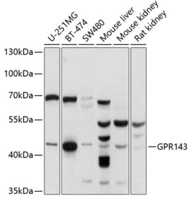 Western Blot OA1 Antibody - BSA Free