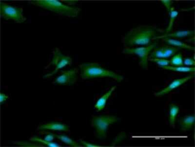 Immunocytochemistry/Immunofluorescence: OAS1 Antibody [H00004938-D03P] - Analysis of antibody to OAS1 on HeLa cell. Antibody concentration 30 ug/ml.
