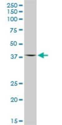 Western Blot: OAS1 Antibody [H00004938-D01P] - Analysis of OAS1 expression in MCF-7.