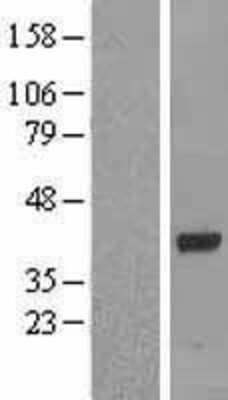 Western Blot: OAS1 Overexpression Lysate (Adult Normal) [NBL1-13896] Left-Empty vector transfected control cell lysate (HEK293 cell lysate); Right -Over-expression Lysate for OAS1.