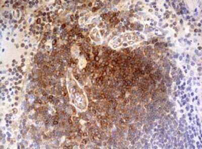 Immunohistochemistry: OAS2 Antibody (6E6) [NBP2-46293] - Analysis of Human lymph node tissue.